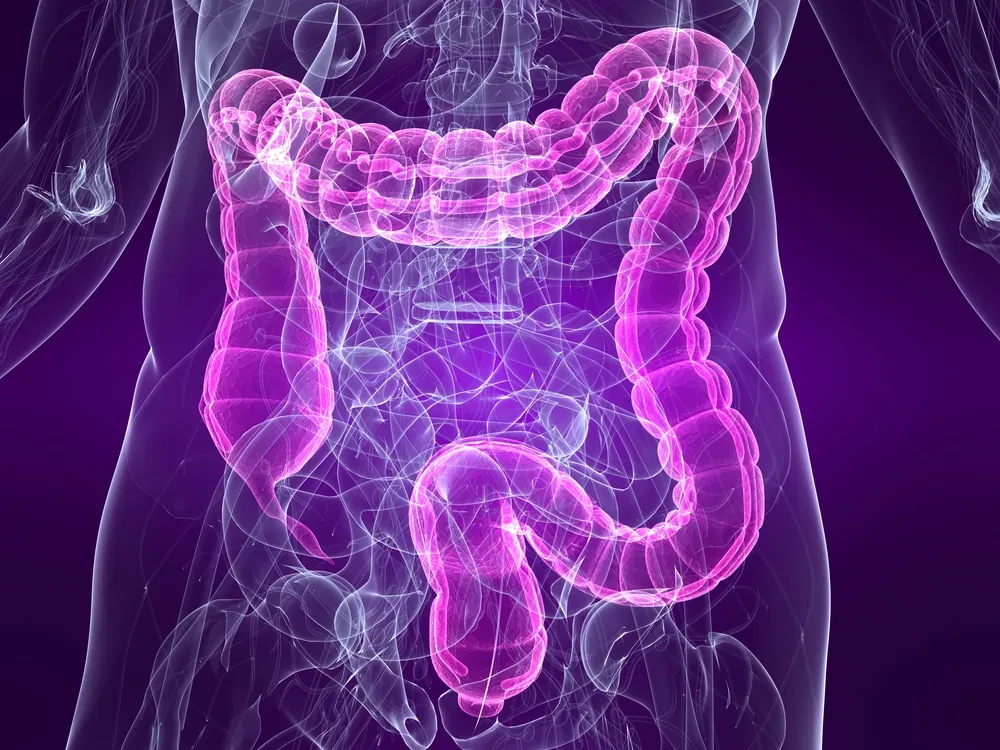 IBS Symptoms And Inflammatory Bowel Disease Might Overlap