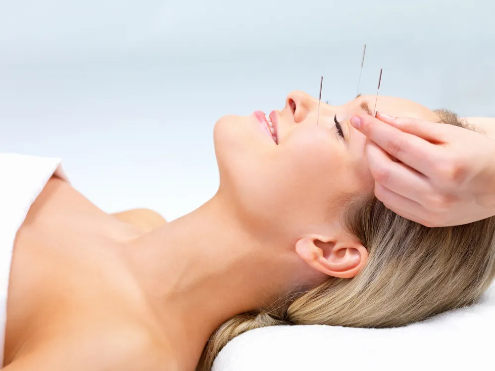 New Study Finds Acupuncture Effective at Treating Headaches, Back Pain