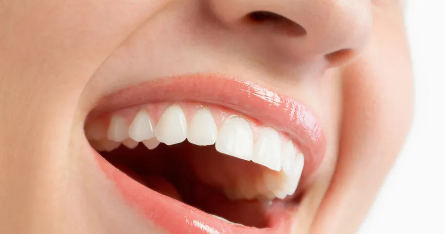 10 Anzeichen, dass Sie zum Zahnarzt müssen