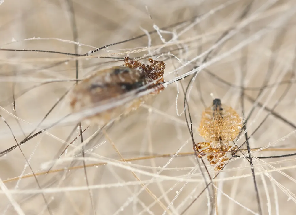 Popular Lice Treatment Can Cause Cancer, WHO Says