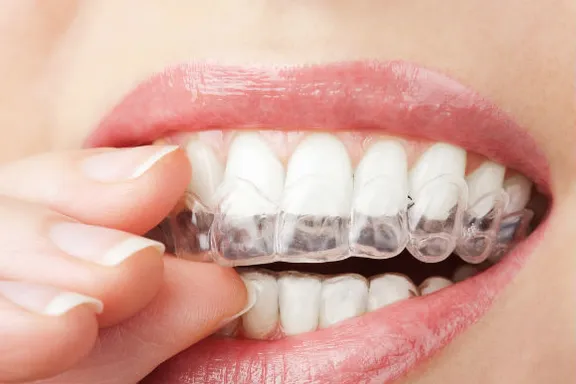 15 maneras naturales de tener dientes más blancos y brillantes