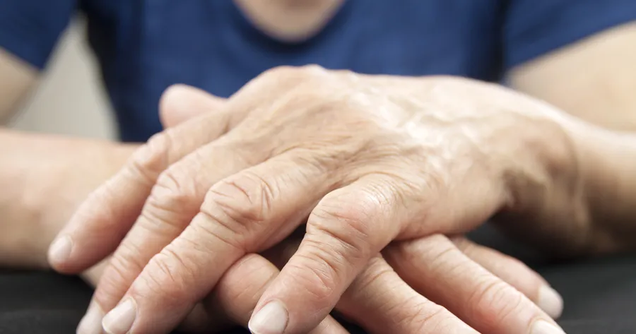 Sintomas da artrite reumatóide: Você tem artrite reumatóide?