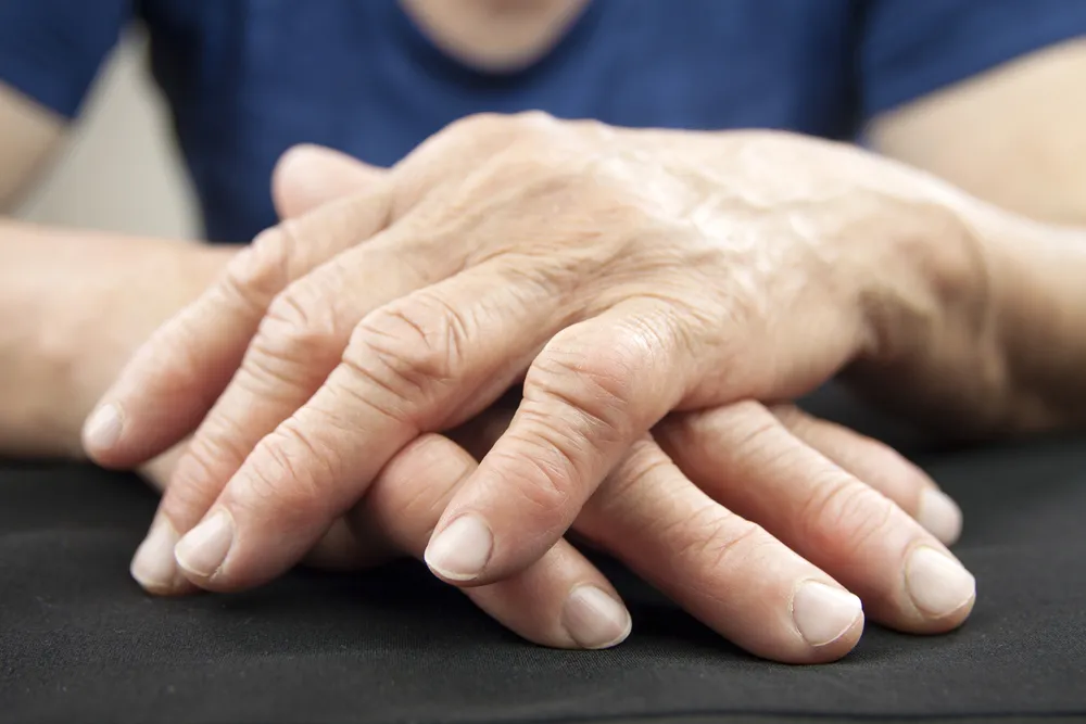Symptoms of Rheumatoid Arthritis: Do You Have Rheumatoid Arthritis?