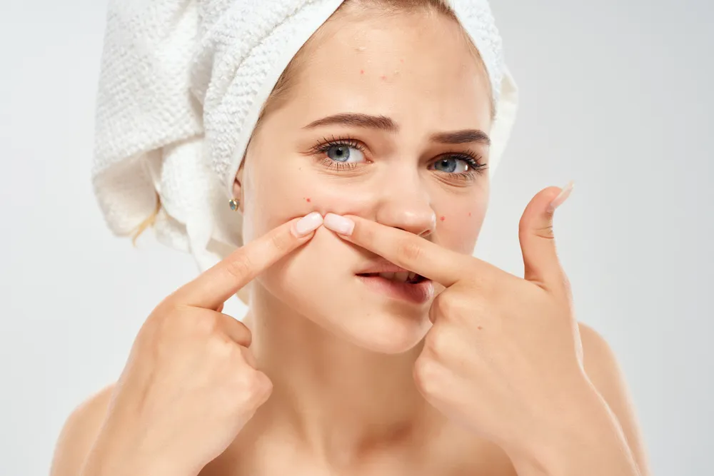 Best Ways to Prevent Acne: Avoid Breakouts With These Tips!