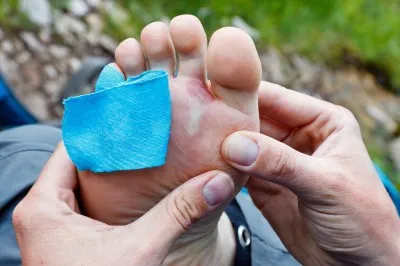 blister 5