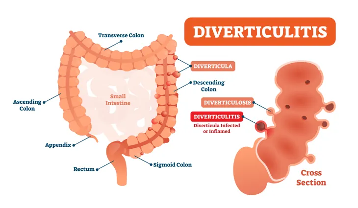 11 Signs and Symptoms of a Kidney Infection – ActiveBeat – Your Daily Dose  of Health Headlines