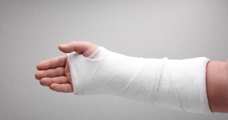 10 posibles causas de dolor en el brazo