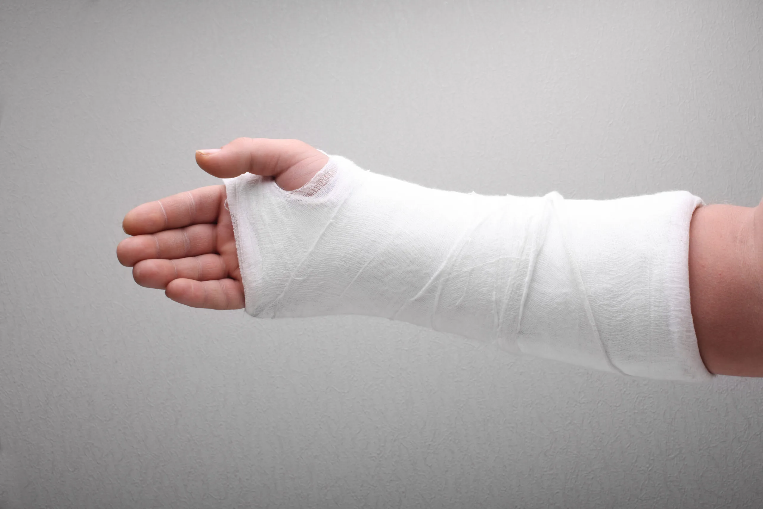 10 posibles causas de dolor en el brazo