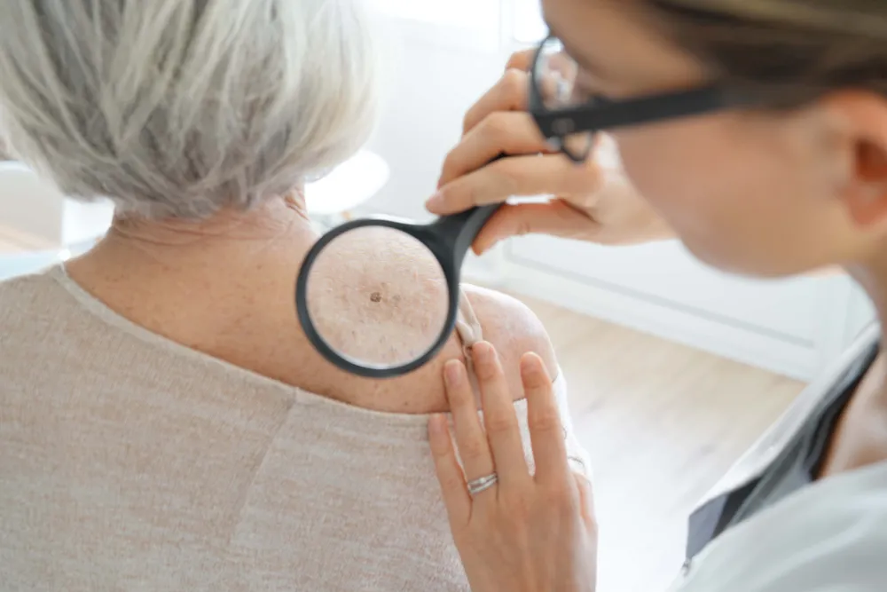 Skin Cancer Screening Guidelines Can Seem Confusing — Three Skin Cancer Researchers Explain When to Consider Getting Checked