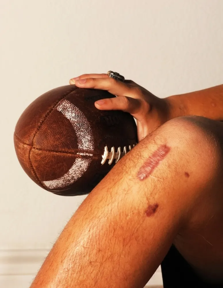 Las 9 lesiones deportivas más comunes