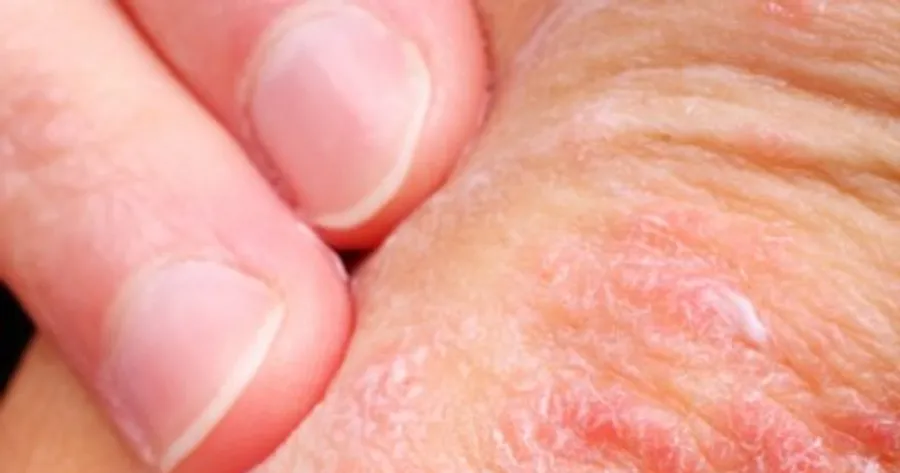10 Mögliche Gründe für Beulen auf Ihrer Haut