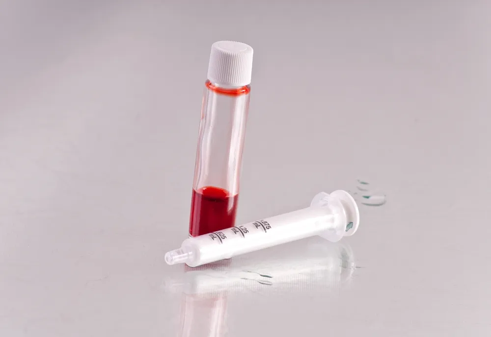 Les 10 Examens Sanguins Les Plus Courants et Leur Usage