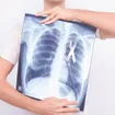 Lung Cancer: 22 Early Signs and Symptoms