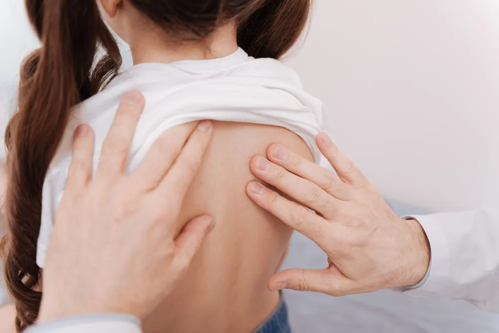 Diagnosing Scoliosis: Common Symptoms and Treatments