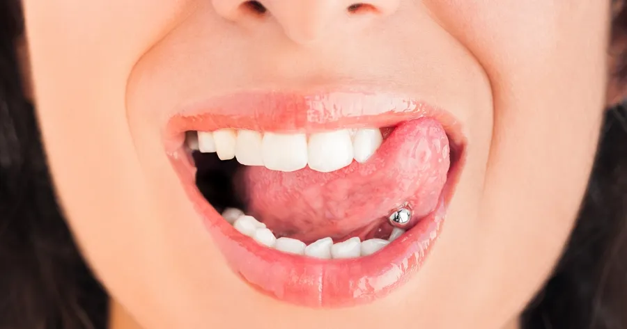 Die 15 schnellsten Wege, Ihre Zähne zu ruinieren.