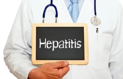 Hepatitis C