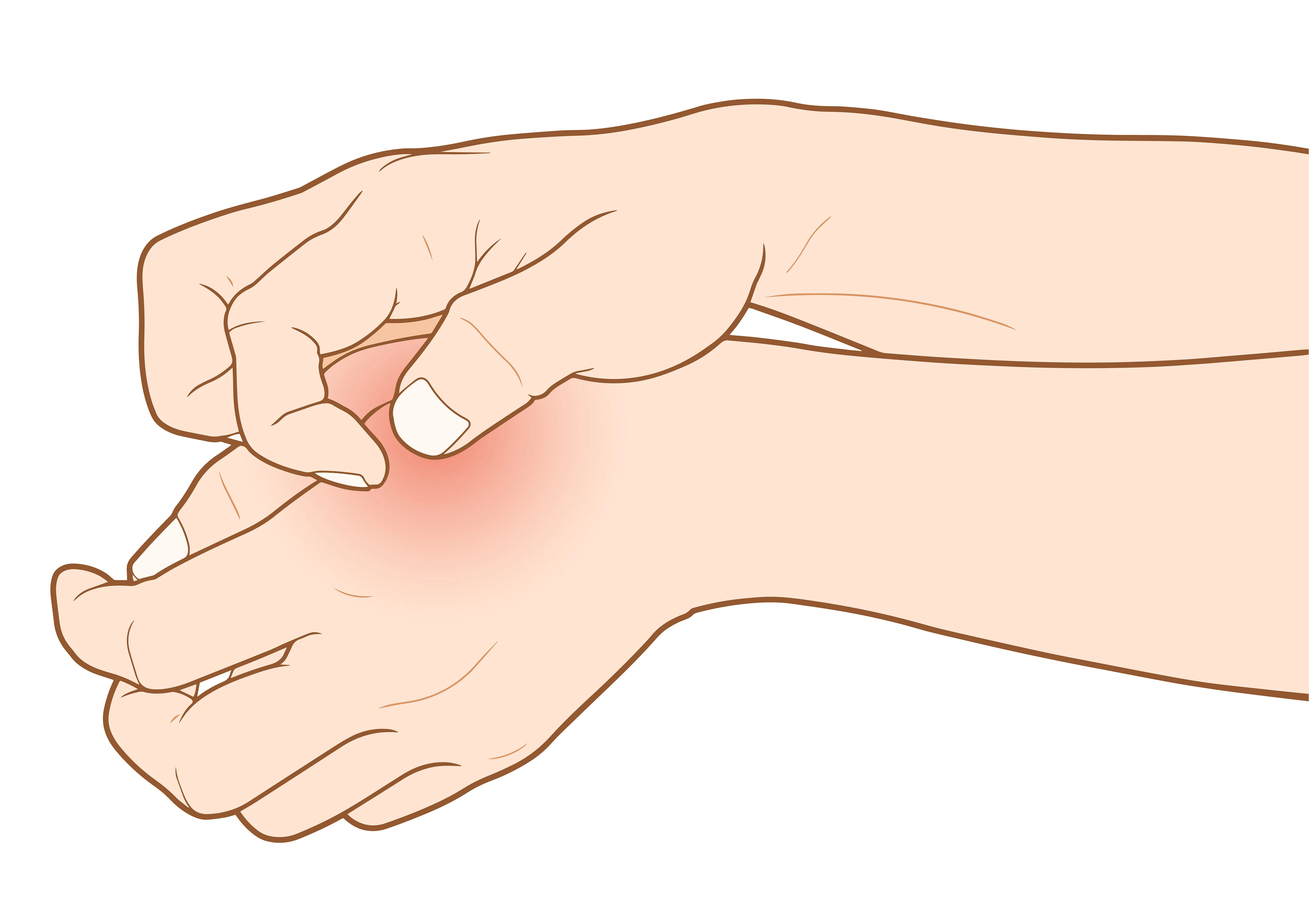 Natural Home Remedies to Banish Warts