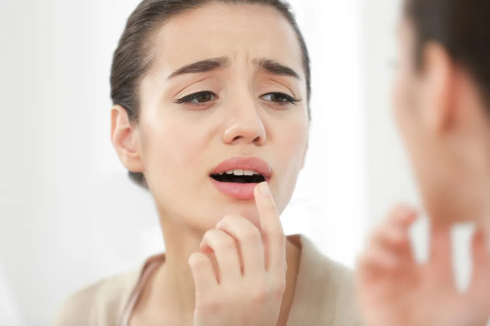 Razones por las que le salen herpes labiales