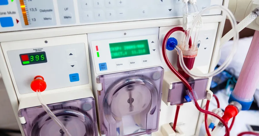 World’s First Infant Kidney Dialysis Machine Saves Newborn’s Life