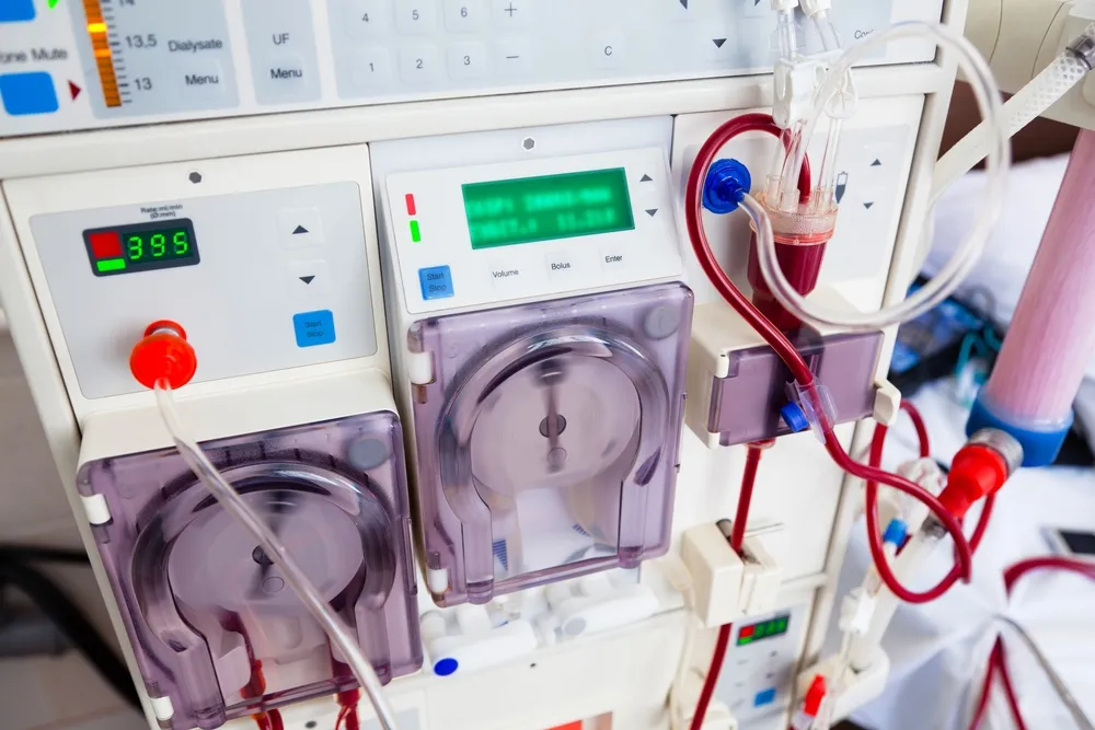 World’s First Infant Kidney Dialysis Machine Saves Newborn’s Life