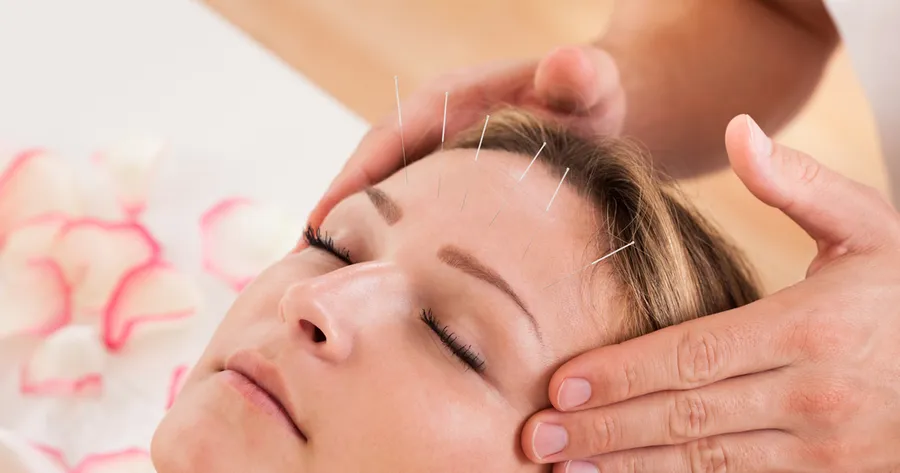 8 Things Most People Don’t Know About Acupuncture