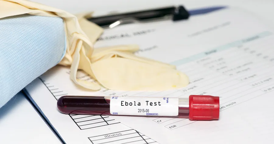 Ebola Outbreak: 10 Common Misconceptions