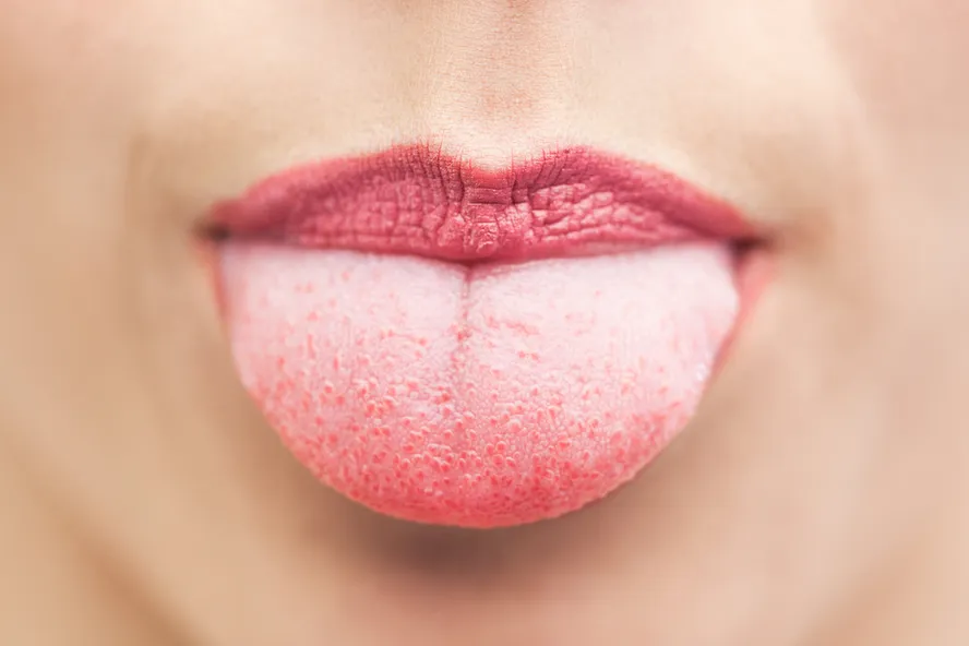 7 choses que votre langue raconte à propos de votre santé