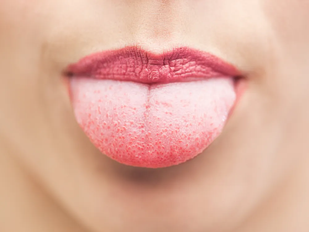 7 Dinge, die unsere Zunge über unsere Gesundheit verrät