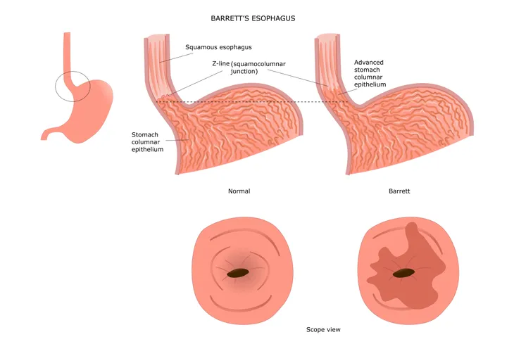 11 Signs and Symptoms of a Kidney Infection – ActiveBeat – Your Daily Dose  of Health Headlines