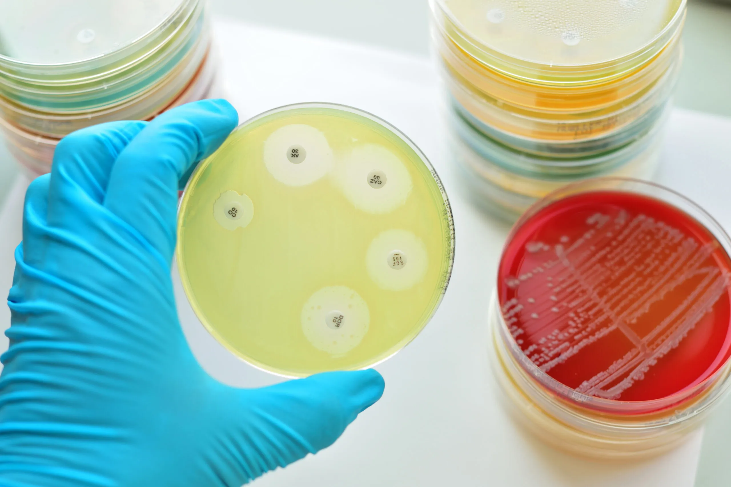 Die Ursachen, Symptome und Behandlung von MRSA