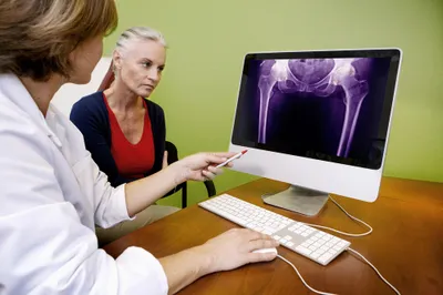 Osteoporosis Female Hip