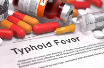 Typhoid Fever