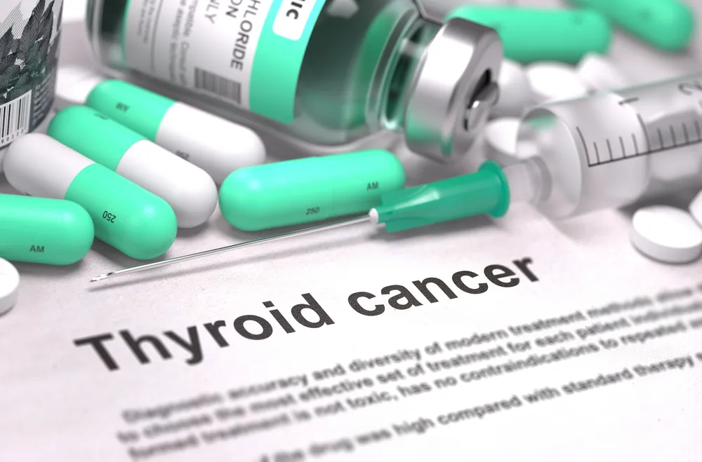 6 informations à savoir sur le cancer de la thyroïde