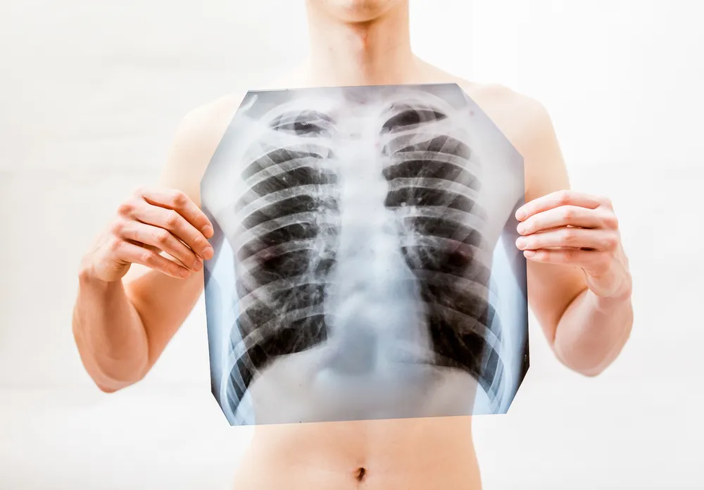 Health Facts About Walking Pneumonia
