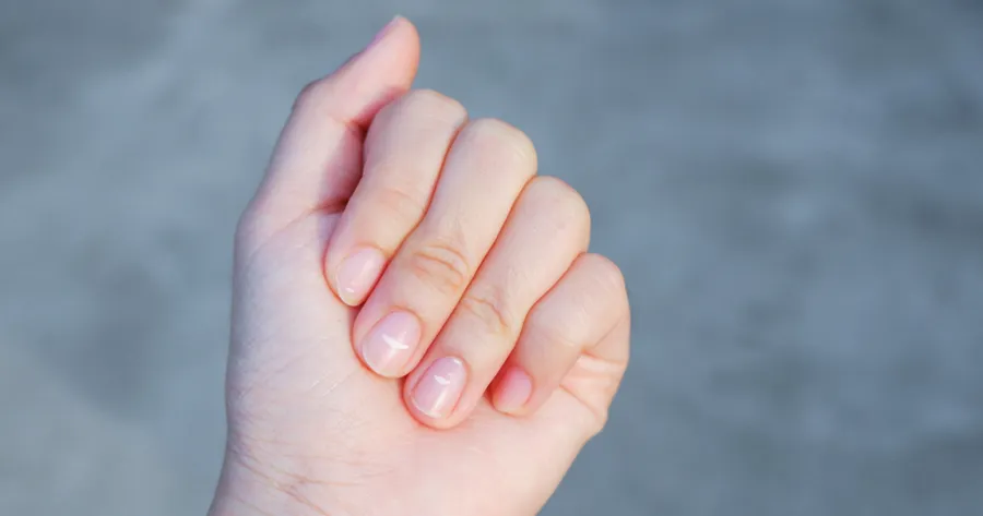 14 problemas de salud comunes relacionados con las uñas