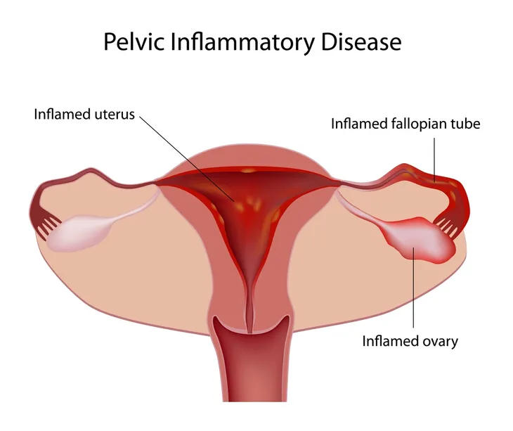 11 Signs and Symptoms of a Kidney Infection – ActiveBeat – Your Daily Dose  of Health Headlines