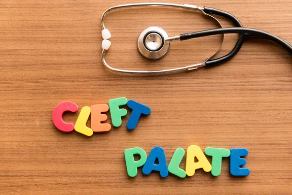 Health Conditions Associated with Cleft Lip or Palate