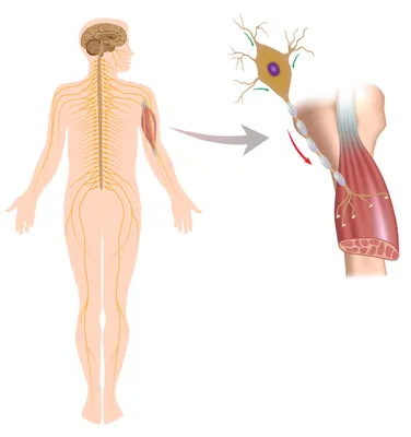 Spinal muscular atrophy