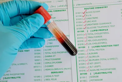 liver blood test