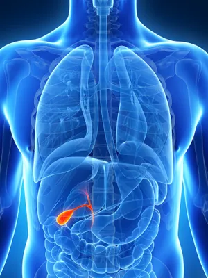 Treatment Options for Gallbladder Problems, Including Gallstones ...