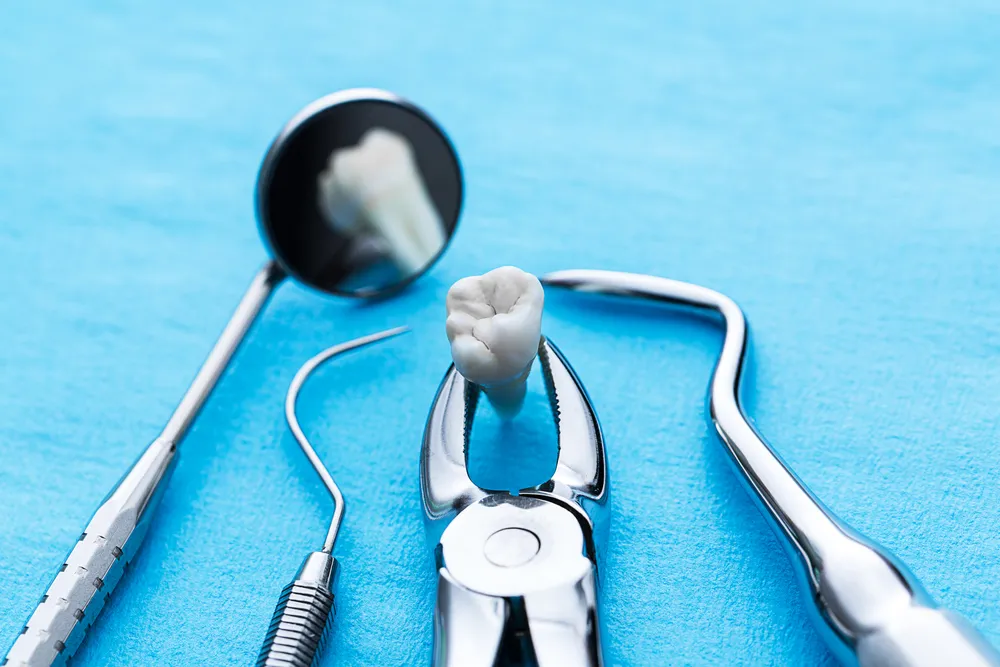 Infographic: Take Me Out—A Brief Guide to Tooth Extraction