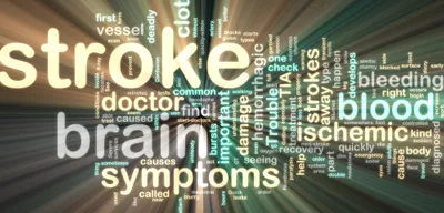  ischemic stroke