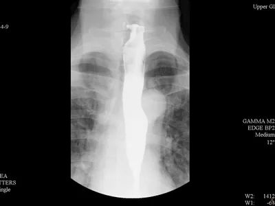 x-ray upper digestive system
