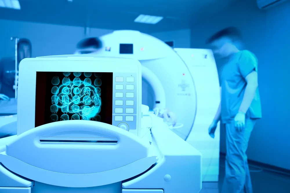 6 Vital Health Impacts of Medical Imaging and Radiation Therapy Professionals