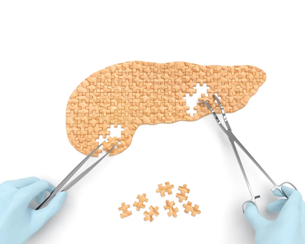 Acute Pancreatitis vs. Chronic Pancreatitis: What’s The Difference?