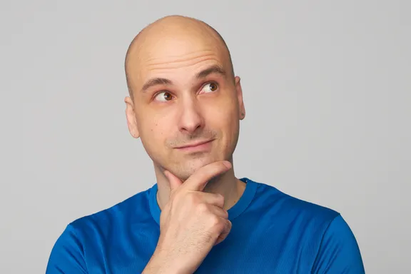 Hair-Raising Facts about Male Baldness