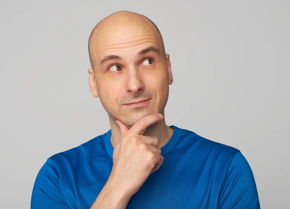 Hair-Raising Facts about Male Baldness