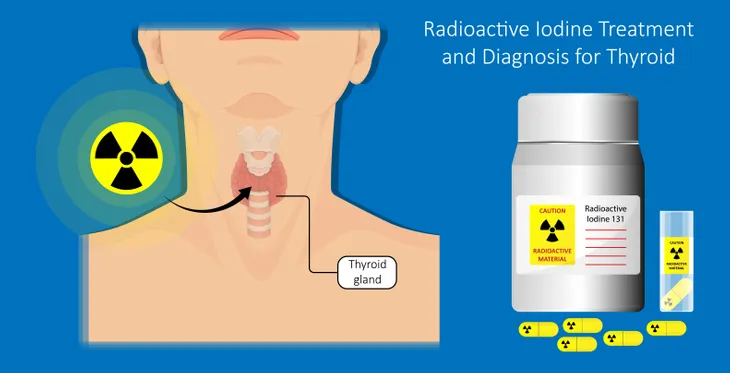 Radioactive store iodine treatment