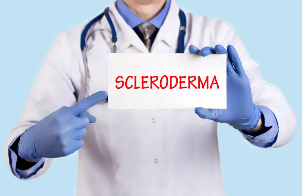 Scleroderma: What You Need to Know