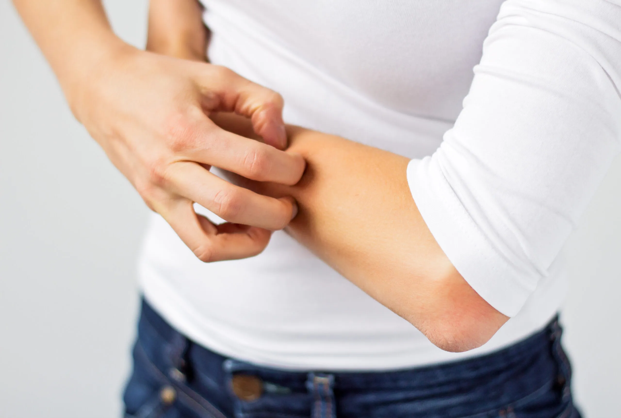 Plaque Psoriasis: Signs, Causes, and Treatment Options